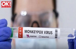 KARACHI HAS THE WORLD’S FIRST CASE OF MONKEYPOX